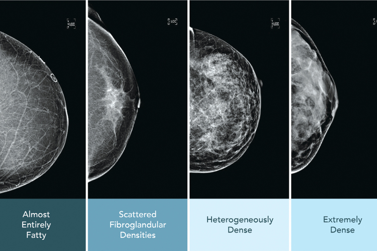 Bayhealth Offers a Clearer Way to Detect Breast Cancer